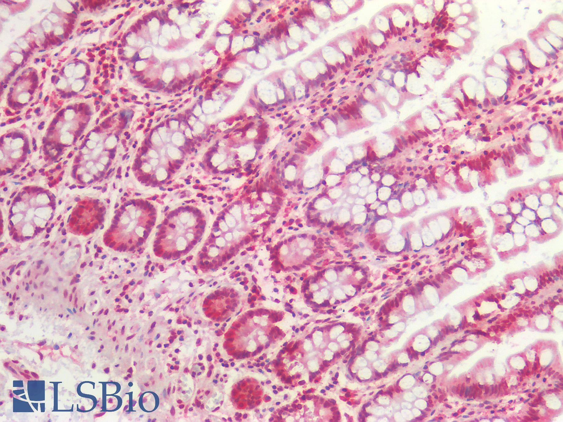 PathPlus™ AKT1 Antibody