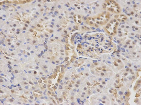 MAPK7 / ERK5 Antibody