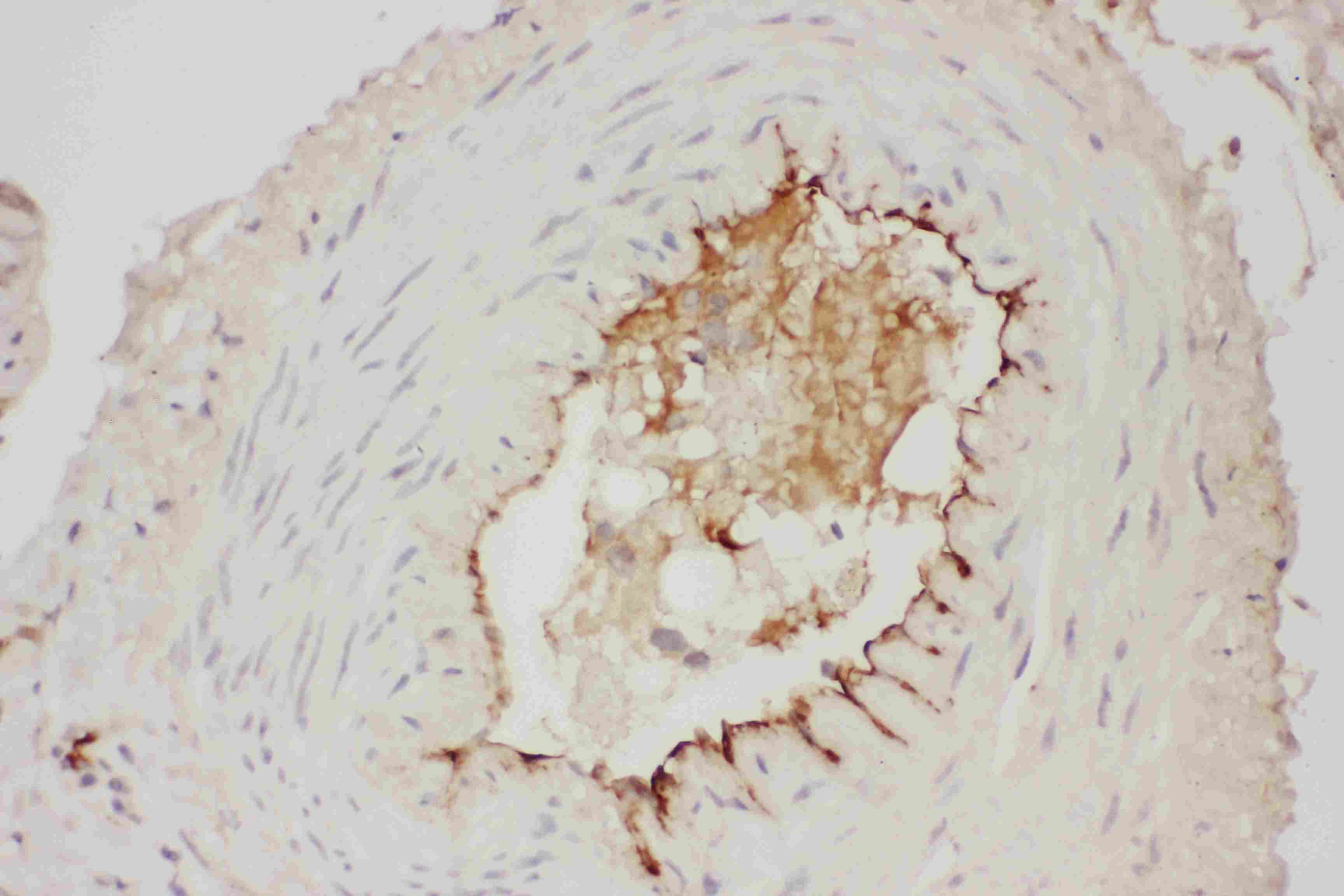Polyclonal Rabbit anti-Human Adiponectin Antibody (aa19-244, IHC, WB)