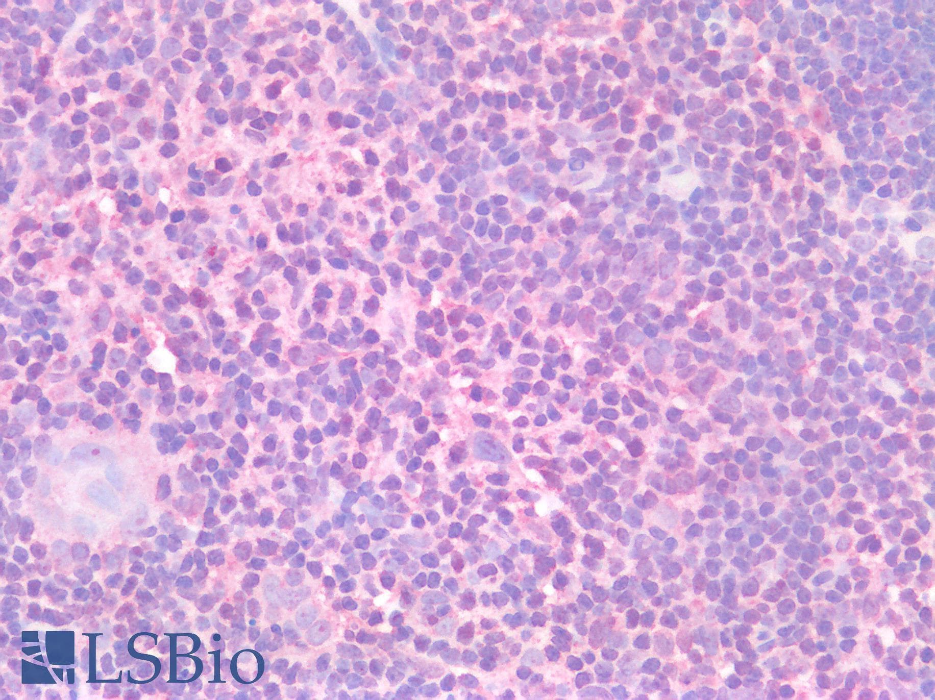 IHC-plus™ STAT5A Antibody (aa681-692)