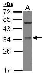 METTL6 Antibody