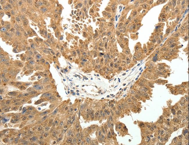PTCH1 / Patched 1 Antibody