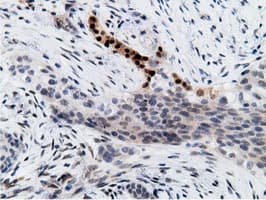 EPM2AIP1 Antibody (clone OTI2G3)