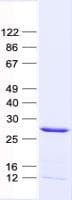 Human GALNT9 Protein (Recombinant His, N-Terminal)