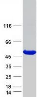 Human HPD Protein (Recombinant Myc-DDK (Flag))