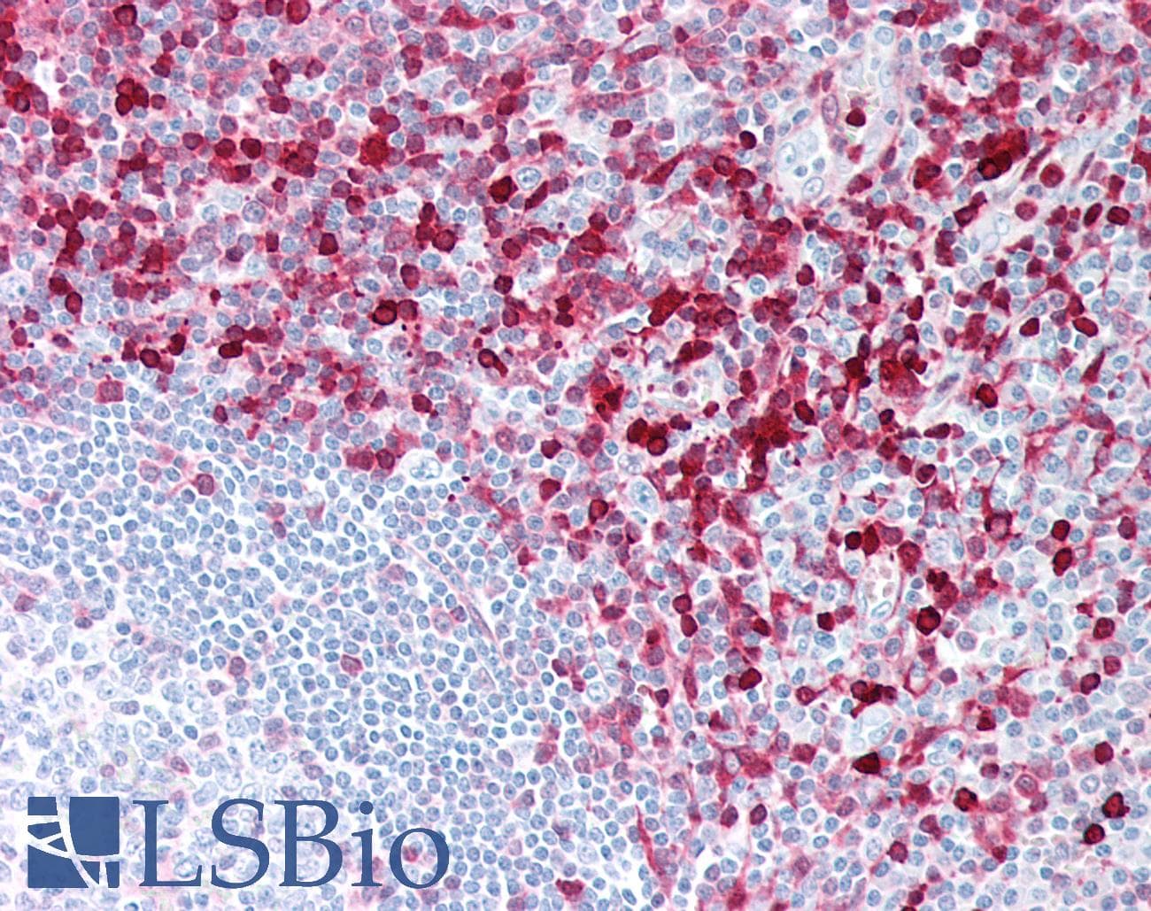 PathPlus™ S100A4 / FSP1 Antibody