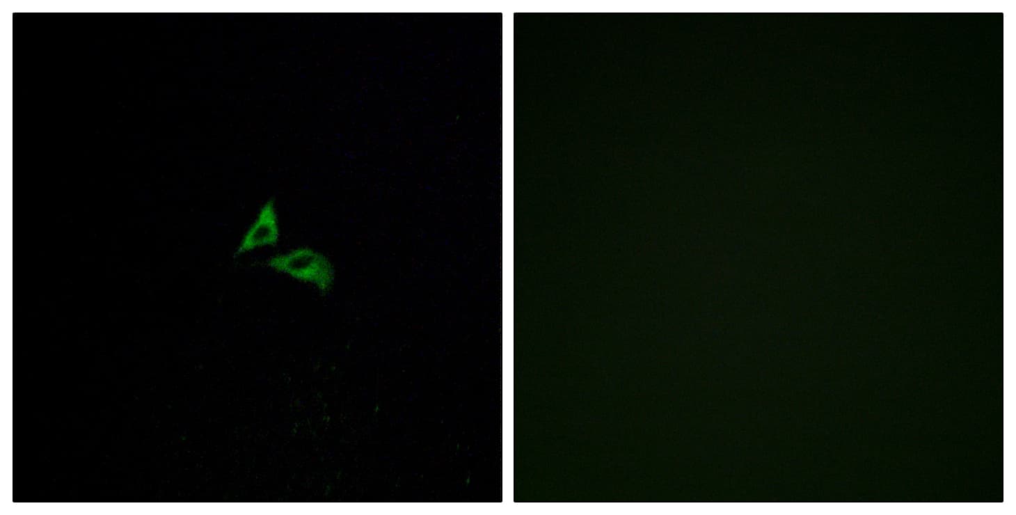 Polyclonal Rabbit anti-Human LPAR3 / LPA3 / EDG7 Antibody (aa281-330, IF, WB)