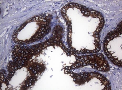 SYNC / SYNCOILIN Antibody (clone OTI5B8)
