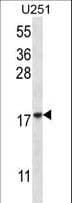 Polyclonal Rabbit anti-Human EIF1AY Antibody (aa1-30, IHC, WB)