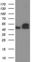 TUBB4 / Tubulin Beta 4 Antibody (clone OTI8E3)