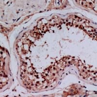 DLC1 Antibody