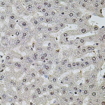 SET / TAF-I Antibody