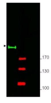 IHC-plus™ GLI2 Antibody (Internal)