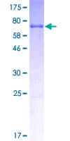 Human CCAR2 / KIAA1967 Protein (Recombinant GST)