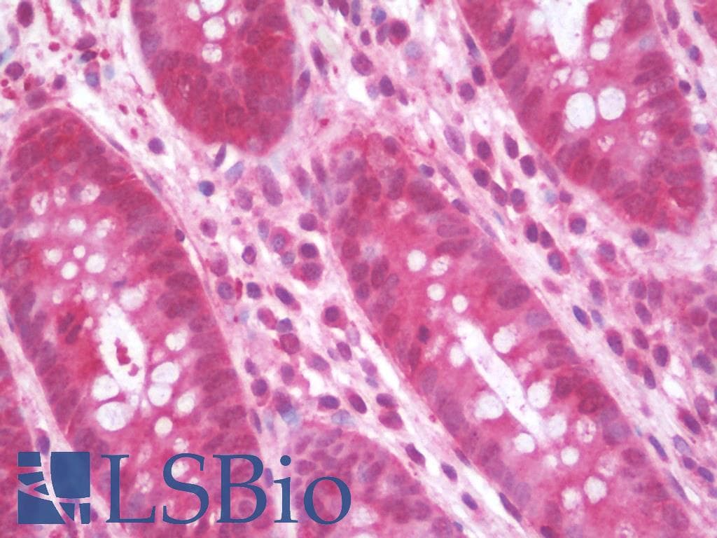 IHC-plus™ Polyclonal Rabbit anti-Human DNM1L / DRP1 Antibody (IHC, IF, WB)