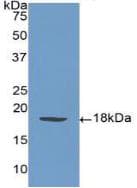 SELP / P-Selectin / CD62P Antibody (aa58-195, Cy3)