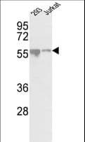 CDKL2 Antibody (aa226-255)