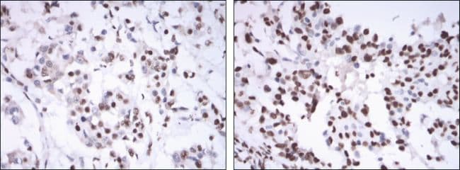 ER Alpha / Estrogen Receptor Antibody (clone 6B6)
