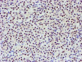 TPRKB Antibody (clone OTI3E3)
