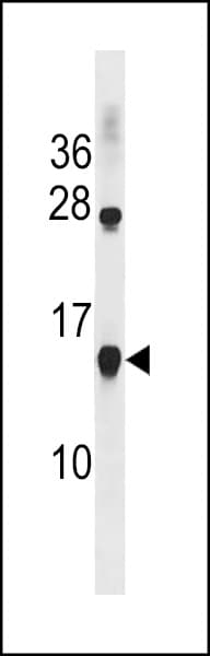 Polyclonal Rabbit anti-Human CCL17 / TARC Antibody (aa65-94, WB)