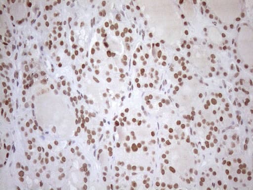 UTP11L Antibody (clone OTI5F3, Carrier-free)