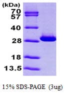 Human TPI1 / TPI Protein (Recombinant His)