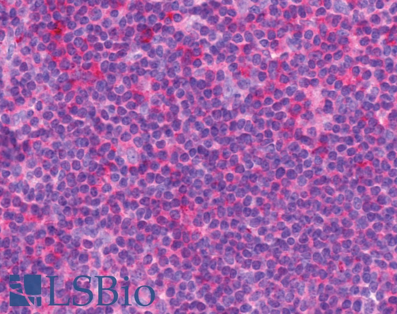 IHC-plus™ Polyclonal Rabbit anti-Human CCKAR / CCK1R Antibody (N-Terminus, IHC)
