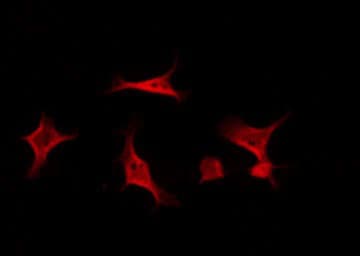 BCAR1 / p130Cas Antibody (phospho-Tyr410)