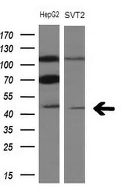 TRB3 / TRIB3 Antibody (aa1-200, clone OTI3F3)