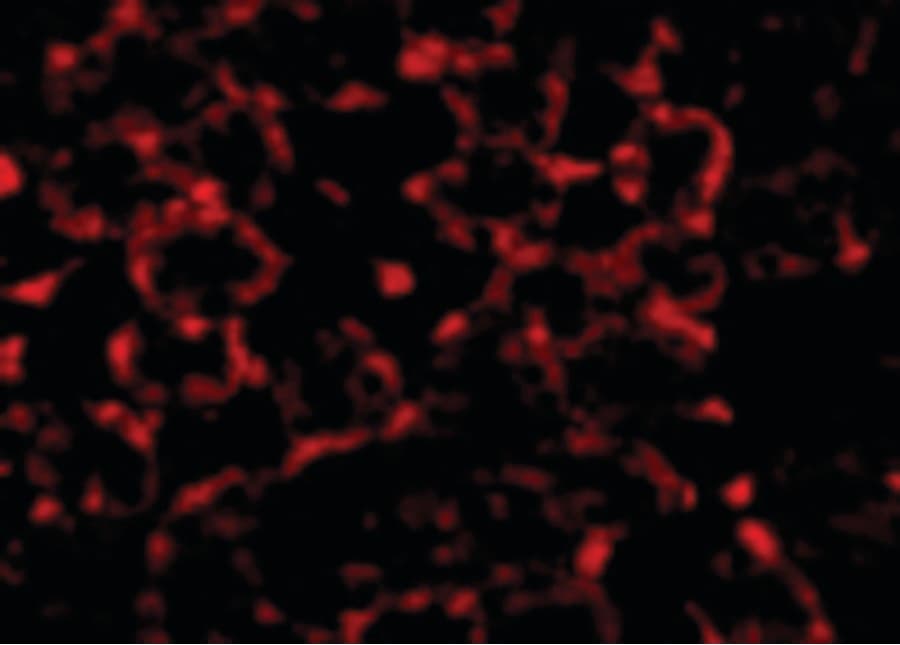 IHC-plus™ Polyclonal Rabbit anti-Human MTCH2 Antibody (IHC, IF, WB)