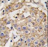 Polyclonal Rabbit anti-Human ERBB2 / HER2 Antibody (IHC, IF, WB)