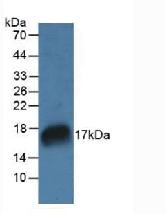 RNASE7 Antibody (aa31-155)