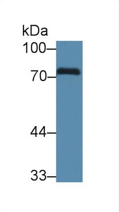 CALD1 / Caldesmon Antibody