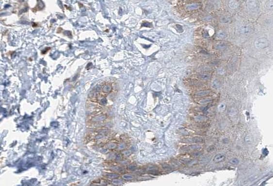 MPS1 / TTK Antibody