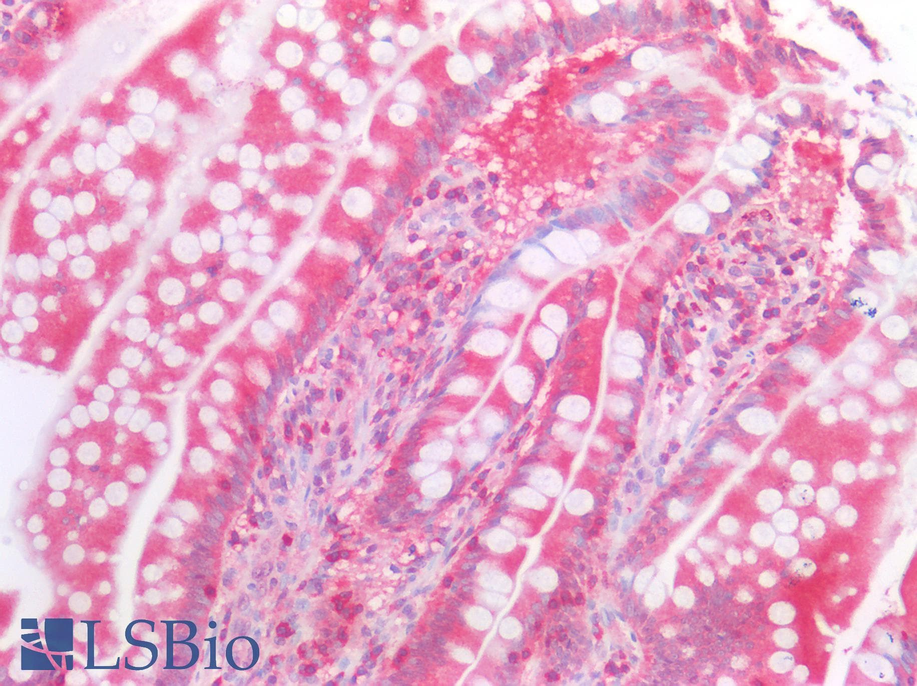 IHC-plus™ BCL2L1 / BCL-XL Antibody (aa1-208)