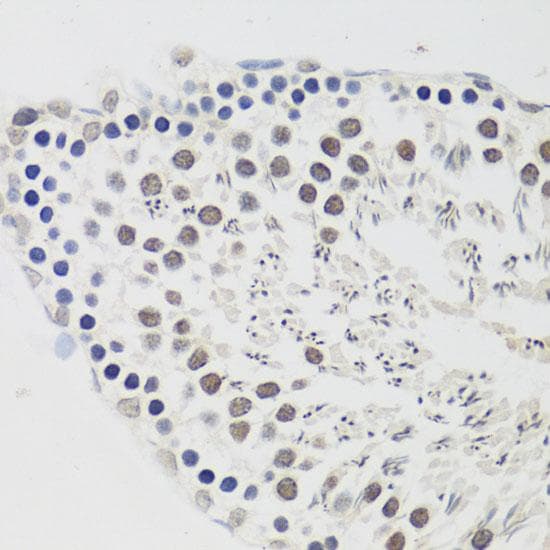 Polyclonal Rabbit anti-Human CCNE2 / Cyclin E2 Antibody (IHC)