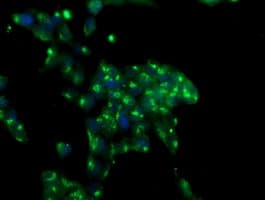 MIF4GD Antibody (clone OTI4C11)