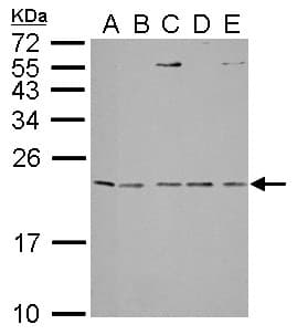 IL1RN Antibody (aa1-177)