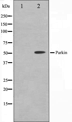 PARK2 / Parkin 2 Antibody