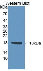 FLRT3 Antibody (aa29-152, HRP)