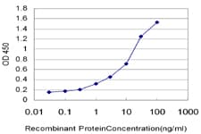 IKBKB / IKK2 / IKK Beta Antibody (clone 2F4)