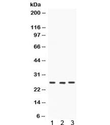 Polyclonal Rabbit anti-Human CACYBP Antibody (IHC, WB)