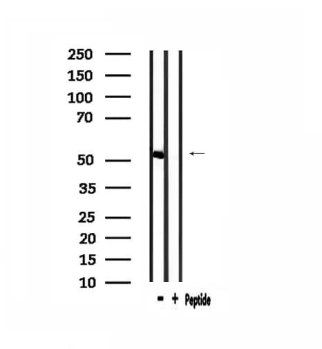 Polyclonal Rabbit anti-Human IP6K3 Antibody (IHC, IF, WB)