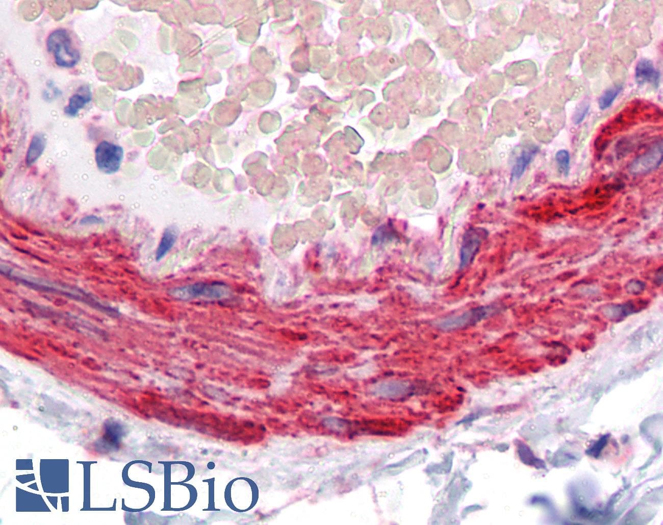 IHC-plus™ ARH / LDLRAP1 Antibody (clone 4G4-D5)