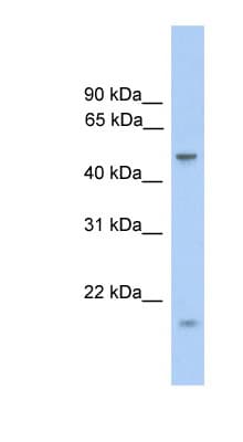 Polyclonal Rabbit anti-Human ZNF213 Antibody (aa215-264, WB)