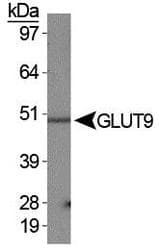 SLC2A9 / GLUT9 Antibody (Internal)
