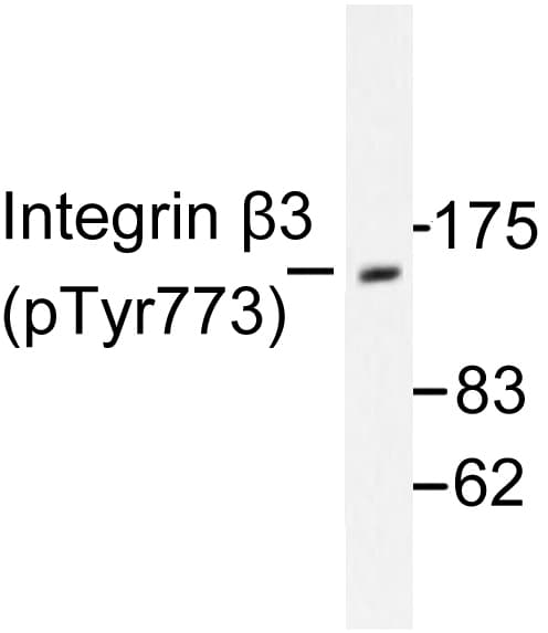 ITGB3 / Integrin Beta 3 / CD61 Antibody (phospho-Tyr773)