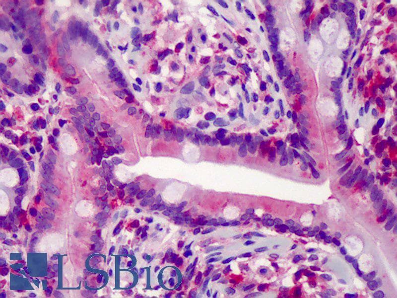 IHC-plus™ CASP7 / Caspase 7 Antibody (clone 25B881.1)