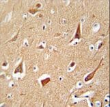 ZFYVE28 Antibody (aa604-633)