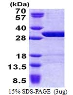Human USP15 Protein (Recombinant His)